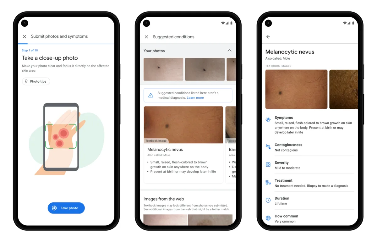 Zo werkt Derm Assist van Google.
